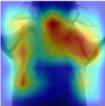 Class activation map of chest x-ray of mouse